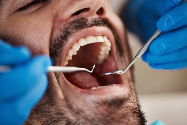 Best Broken or Chipped Tooth Repair in Galax, VA